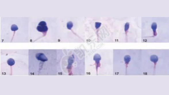 畸形率高98%还能生育吗 怀孕了会是畸形？(图2)