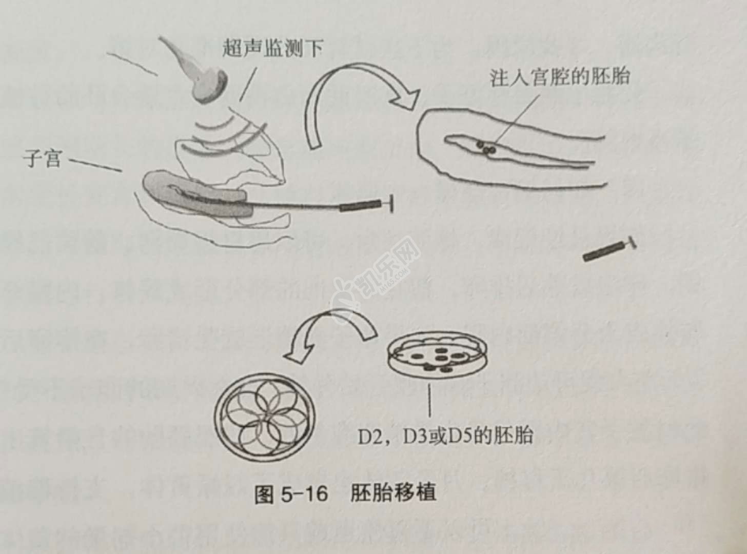 试管时间和流程安排是怎样的(附真实流程图)(图4)