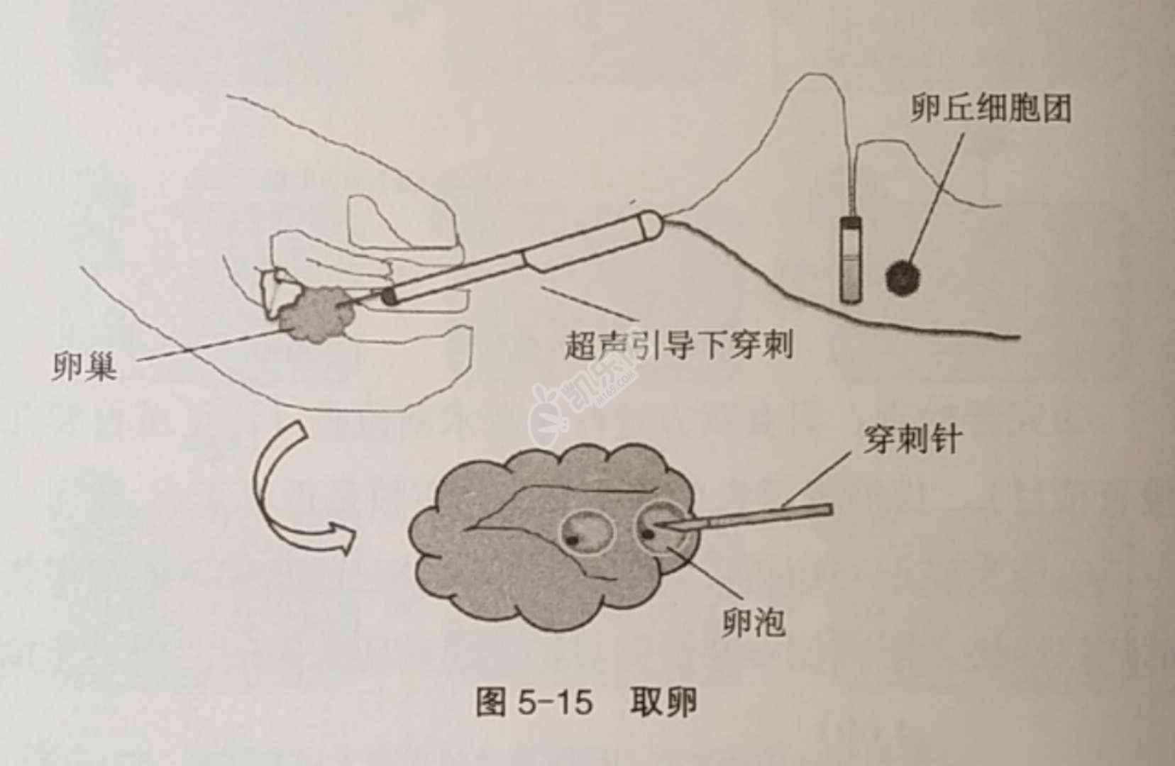 试管时间和流程安排是怎样的(附真实流程图)(图5)