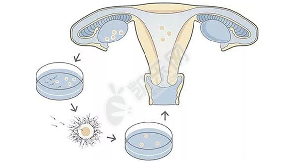 供卵试管婴儿费用组成大概多少钱(图3)