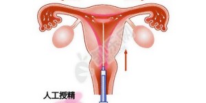 人工授精最好的10大生殖医院
