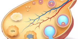 卵泡发育不好怎么办 ，最新相关问题答疑汇总