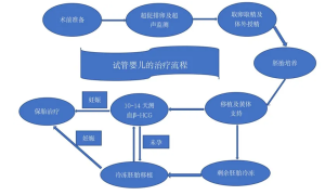 一文看懂试管治疗流程，记住四个阶段，做三代其实没这么复杂!