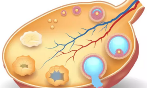 卵泡发育不好怎么办 ，最新相关问题答疑汇总